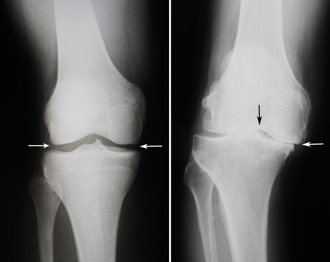 Orthopaedic Evaluation